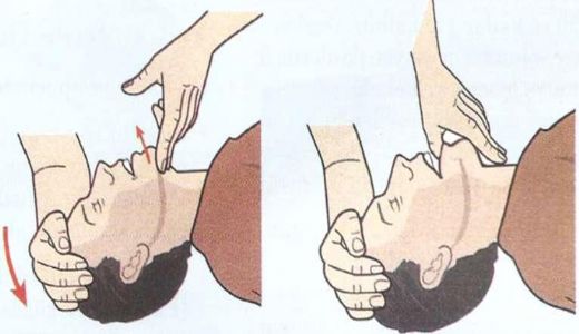 Solunum Durması Belirtileri ve Tedavisi