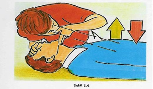 Solunum Yolu Tıkanması Belirtileri ve Tedavisi